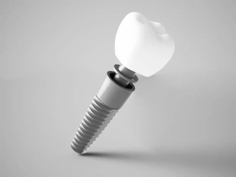 Dental implant post