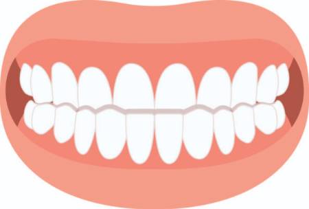 Underbite graphic
